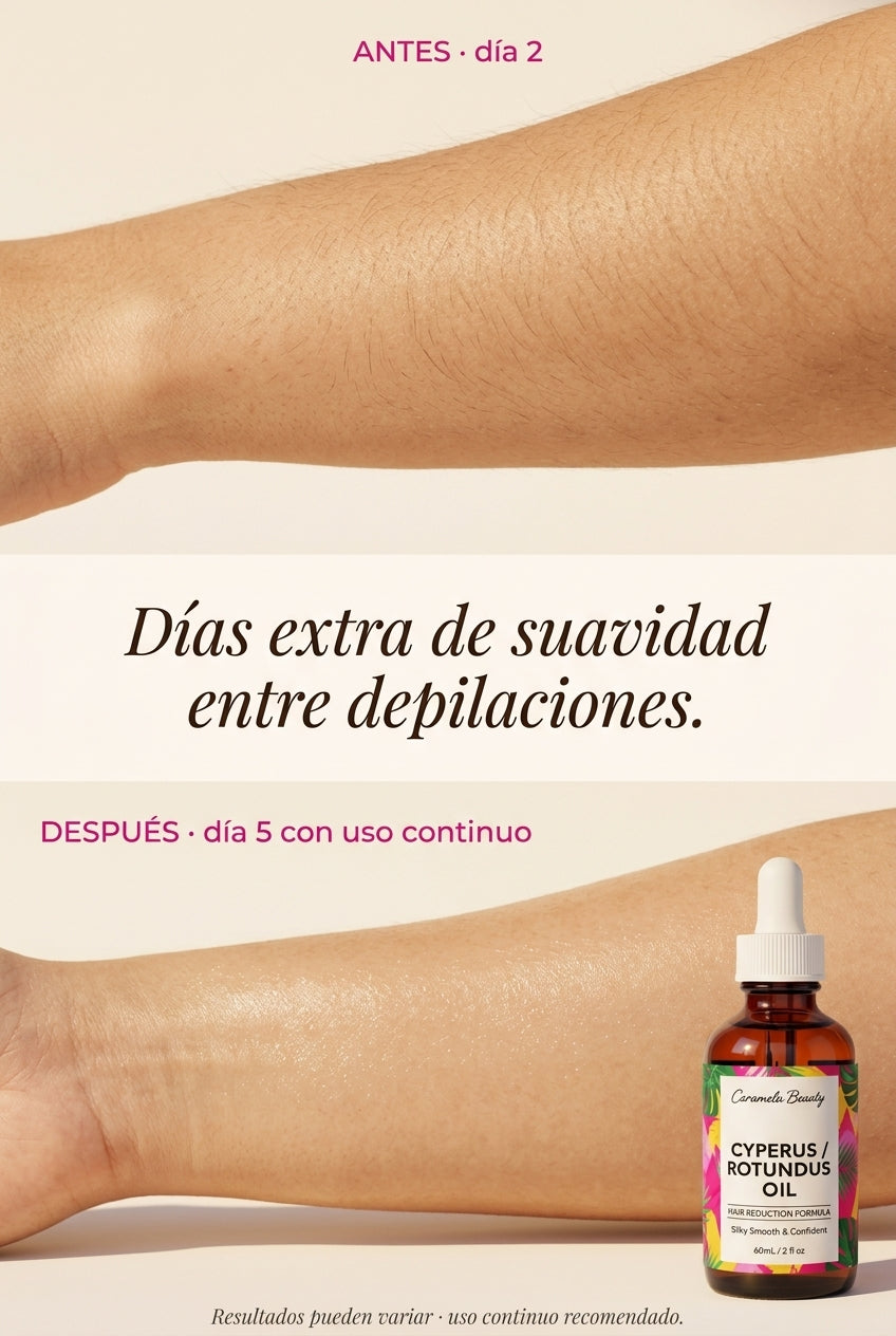 Transformación (resultados pueden variar)