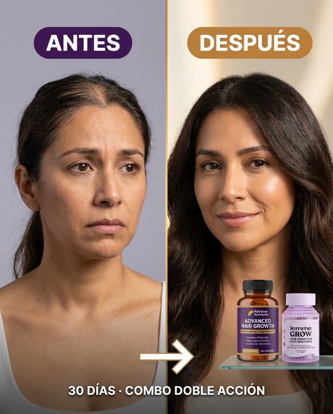 Antes vs Después · 30 días con el combo SOS Cabello